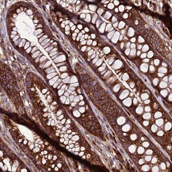 ZC3HAV1 Polyclonal Antibody:Antibodies, Polyclonal