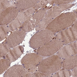 ZC3HAV1 Polyclonal Antibody:Antibodies, Polyclonal