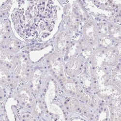 Invitrogen PPP1R17 Polyclonal Antibody 100 &mu;L; Unconjugated:Antibodies,