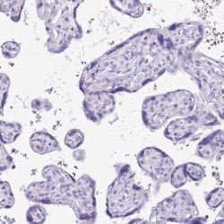Invitrogen PPP1R17 Polyclonal Antibody 100 &mu;L; Unconjugated:Antibodies,