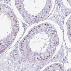 Invitrogen PPP1R17 Polyclonal Antibody 100 &mu;L; Unconjugated:Antibodies,