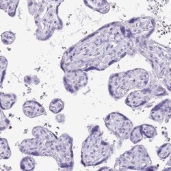 Invitrogen PPP1R17 Polyclonal Antibody 100 &mu;L; Unconjugated:Antibodies,