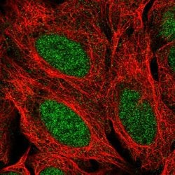 Invitrogen PPP1R17 Polyclonal Antibody 100 &mu;L; Unconjugated:Antibodies,