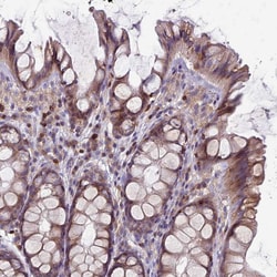 Invitrogen RAC1/RAC2/RAC3 Polyclonal Antibody 100 &mu;L; Unconjugated:Antibodies,