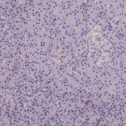 Invitrogen RAC1/RAC2/RAC3 Polyclonal Antibody 100 &mu;L; Unconjugated:Antibodies,