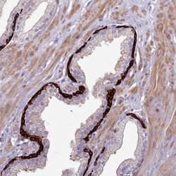 Invitrogen RAC1/RAC2/RAC3 Polyclonal Antibody 100 &mu;L; Unconjugated:Antibodies,