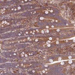 Invitrogen FAM21A Polyclonal Antibody 100 &mu;L; Unconjugated:Antibodies,