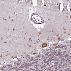 Invitrogen RBM4B Polyclonal Antibody 100 &mu;L; Unconjugated:Antibodies,