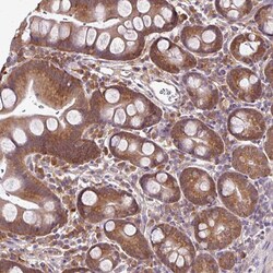 Invitrogen RBM4B Polyclonal Antibody 100 &mu;L; Unconjugated:Antibodies,