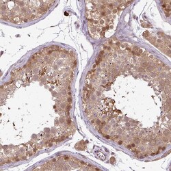 Invitrogen RBM4B Polyclonal Antibody 100 &mu;L; Unconjugated:Antibodies,
