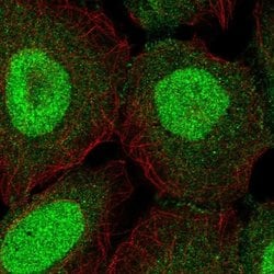 Invitrogen ZNF497 Polyclonal Antibody 100 &mu;L; Unconjugated:Antibodies,