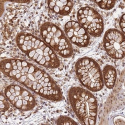Invitrogen ZNF497 Polyclonal Antibody 100 &mu;L; Unconjugated:Antibodies,