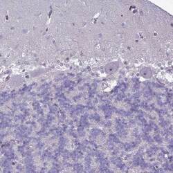 SLC15A3 Polyclonal Antibody:Antibodies, Polyclonal