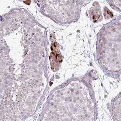 SLC15A3 Polyclonal Antibody:Antibodies, Polyclonal