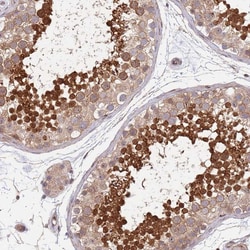 Invitrogen TBX10 Polyclonal Antibody 100 &mu;L; Unconjugated:Antibodies,