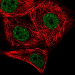 Invitrogen PATZ1 Polyclonal Antibody 100 &mu;L; Unconjugated:Antibodies,