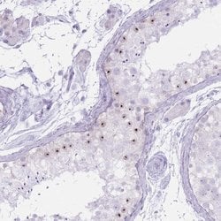 Invitrogen PNMA3 Polyclonal Antibody 100 &mu;L; Unconjugated:Antibodies,