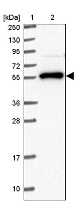 Invitrogen NACC2 Polyclonal Antibody 100 &mu;L; Unconjugated:Antibodies,