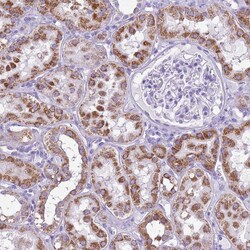 Invitrogen ACSS3 Polyclonal Antibody 100 &mu;L; Unconjugated:Antibodies,