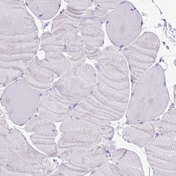 Invitrogen ACSS3 Polyclonal Antibody 100 &mu;L; Unconjugated:Antibodies,