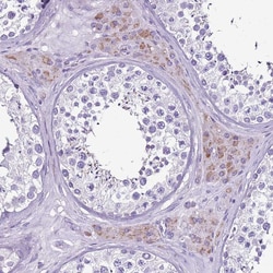 Invitrogen ACSS3 Polyclonal Antibody 100 &mu;L; Unconjugated:Antibodies,