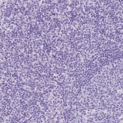 Invitrogen ACSS3 Polyclonal Antibody 100 &mu;L; Unconjugated:Antibodies,