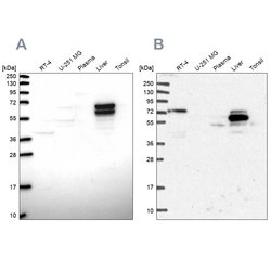 Invitrogen ACSS3 Polyclonal Antibody 100 &mu;L; Unconjugated:Antibodies,