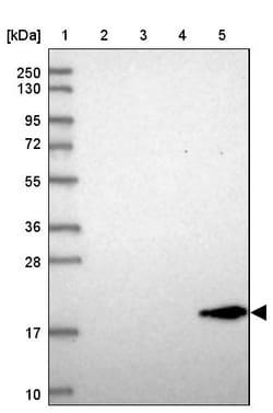 Invitrogen REEP6 Polyclonal Antibody 100 &mu;L; Unconjugated:Antibodies,
