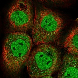 Invitrogen YLPM1 Polyclonal Antibody 100 &mu;L; Unconjugated:Antibodies,