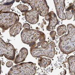 Invitrogen STARD4 Polyclonal Antibody 100 &mu;L; Unconjugated:Antibodies,