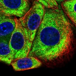 Invitrogen RPS10 Polyclonal Antibody 100 &mu;L; Unconjugated:Antibodies,