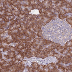 Invitrogen RPS10 Polyclonal Antibody 100 &mu;L; Unconjugated:Antibodies,