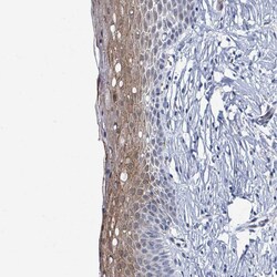 Invitrogen WDR22 Polyclonal Antibody 100 &mu;L; Unconjugated:Antibodies,