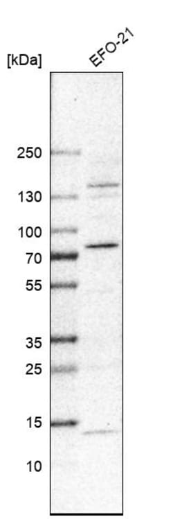 Invitrogen TDE1 Polyclonal Antibody 100 &mu;L | Buy Online | Invitrogen&trade; | Fisher Scientific