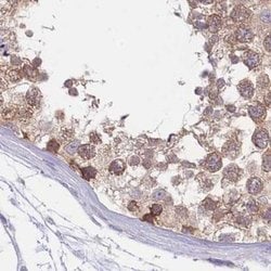 Invitrogen PFDN6 Polyclonal Antibody 100 &mu;L; Unconjugated:Antibodies,