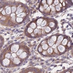 Invitrogen PFDN6 Polyclonal Antibody 100 &mu;L; Unconjugated:Antibodies,