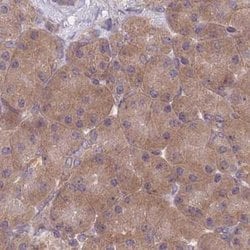 Invitrogen PFDN6 Polyclonal Antibody 100 &mu;L; Unconjugated:Antibodies,