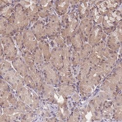 Invitrogen PFDN6 Polyclonal Antibody 100 &mu;L; Unconjugated:Antibodies,
