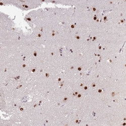 Invitrogen C11orf46 Polyclonal Antibody 100 &mu;L; Unconjugated:Antibodies,