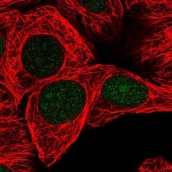 Invitrogen GSTO2 Polyclonal Antibody 100 &mu;L; Unconjugated:Antibodies,