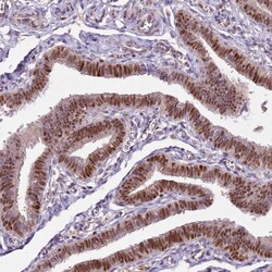 Invitrogen GSTO2 Polyclonal Antibody 100 &mu;L; Unconjugated:Antibodies,