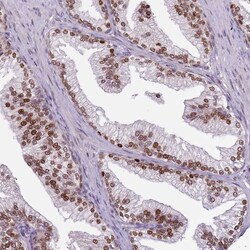 Invitrogen GSTO2 Polyclonal Antibody 100 &mu;L; Unconjugated:Antibodies,