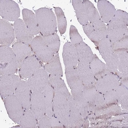 Invitrogen GSTO2 Polyclonal Antibody 100 &mu;L; Unconjugated:Antibodies,
