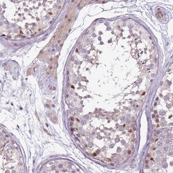 Invitrogen GSTO2 Polyclonal Antibody 100 &mu;L; Unconjugated:Antibodies,