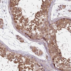 Invitrogen SPDL1 Polyclonal Antibody 100 &mu;L; Unconjugated:Antibodies,
