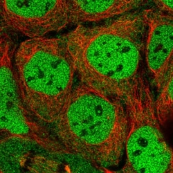 Invitrogen SIK3 Polyclonal Antibody 100 &mu;L; Unconjugated:Antibodies,