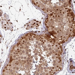 Invitrogen SIK3 Polyclonal Antibody 100 &mu;L; Unconjugated:Antibodies,