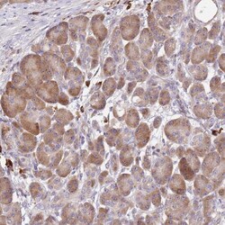 Invitrogen CCDC140 Polyclonal Antibody 100 &mu;L; Unconjugated:Antibodies,