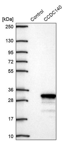 Invitrogen CCDC140 Polyclonal Antibody 100 &mu;L; Unconjugated:Antibodies,
