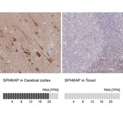 Invitrogen SPHKAP Polyclonal Antibody 100 &mu;L; Unconjugated:Antibodies,